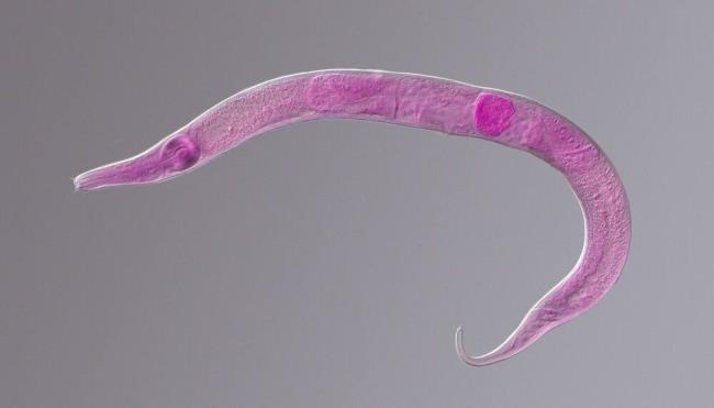 Nematode roundworm stained under the phase co<em></em>ntrast microscope ( (Hussmann / Shutterstock)