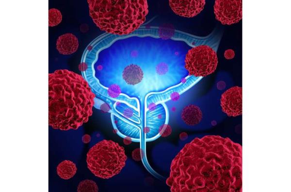 Research into use of diabetes medication for treatment of me<em></em>tastatic prostate cancer