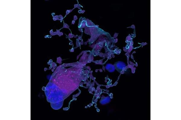 科学家发现，脂质代谢紊乱可能会影响血小板的产生