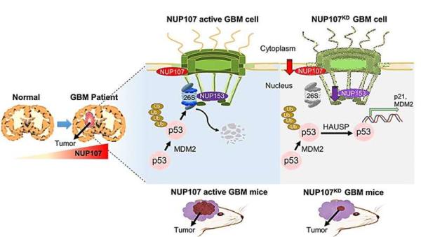 Brain cancer l<em></em>inked to nuclear pore alterations